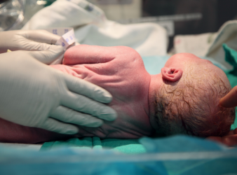 preterm birth