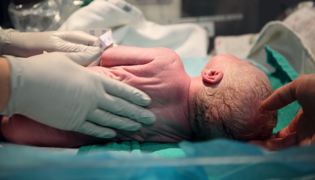 preterm birth