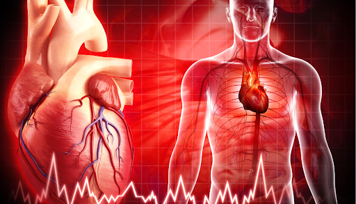TAVI, transcatheter aortic valve implantation, valve durability, hemodynamic valve deterioration, cardiology CME, valve sizing, aortic stenosis treatment, valve reintervention, VARC-3, surgical AVR, cardiac imaging, valve outcomes, echocardiography follow-up, interventional cardiology, Society of Thoracic Surgeons