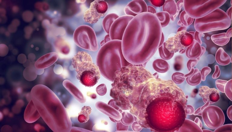 Tracking Immune Cells in Blood Predicts Cancer Survival - eMedNews