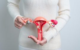 Endometriosis Treatment Advances