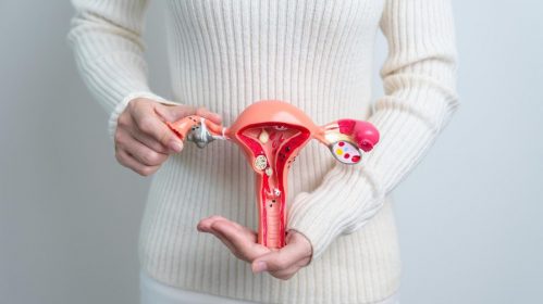 Endometriosis Treatment Advances