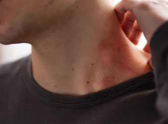Lyme Disease Symptoms: Why They Linger After Treatment