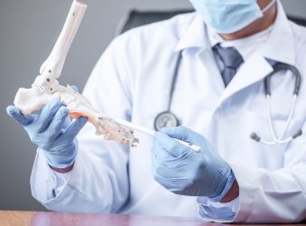 Lipid Accumulation Product Predicts Bone Loss