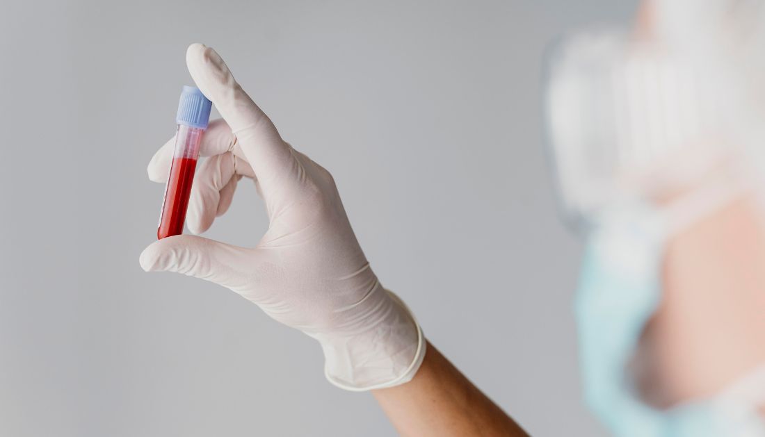 Multi-Cancer Early Detection Test Saves Lives
