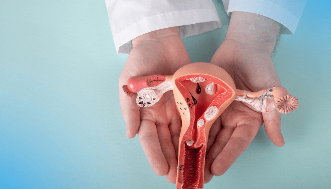 Gut Microbiota Diet Score and Infertility