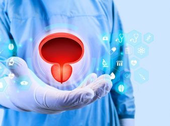 Cell Painting Identifies Flavonoids for Bladder Cancer