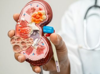 Breath Sensor for Chronic Kidney Disease Detection