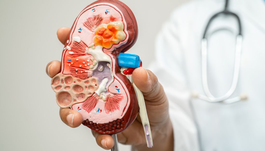 Breath Sensor for Chronic Kidney Disease Detection