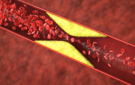 Statins and Depression