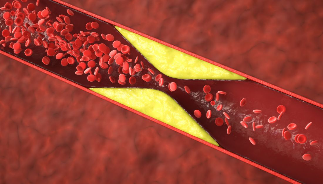 Statins and Depression