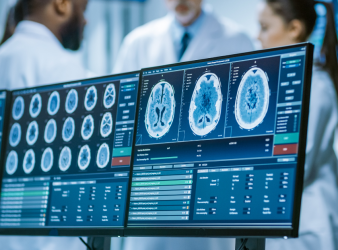 speech and language disorders, neurocomputational study, GPT embeddings, brain language networks, spontaneous conversation, real-time dialogue processing, sentence and discourse integration, cortical mechanisms, language processing in the brain, speech and language disorders, overlapping brain areas,