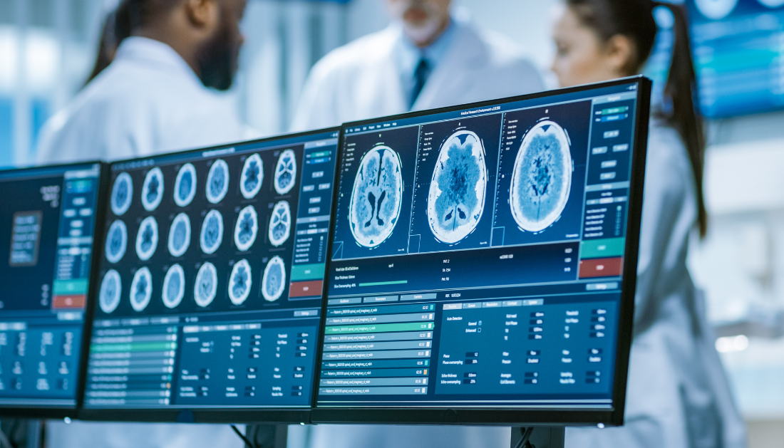 speech and language disorders, neurocomputational study, GPT embeddings, brain language networks, spontaneous conversation, real-time dialogue processing, sentence and discourse integration, cortical mechanisms, language processing in the brain, speech and language disorders, overlapping brain areas,
