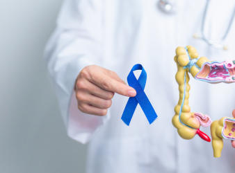 diverticulitis, risk reduction, healthy lifestyle, fiber diet, exercise, smoking cessation, weight management, colon health