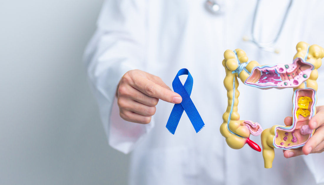 diverticulitis, risk reduction, healthy lifestyle, fiber diet, exercise, smoking cessation, weight management, colon health