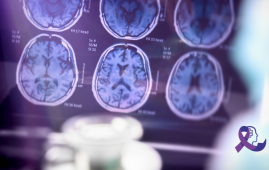 Alzheimer’s disease, cerebral blood flow, CDI test, mild cognitive impairment, USC research, vasomotor reactivity, cognitive decline, Doppler ultrasound, non-invasive diagnosis, neurodegenerative disease, brain oxygenation, NIH study, tau tangles, amyloid plaques, transcutaneous vagal stimulation