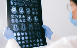 Progressive MS research, MS Clinical and Imaging Data Resource, multiple sclerosis clinical trials, neuroimaging biomarkers, AI in MS, MRI scans MS, progressive MS treatment, MS Alliance, harmonized MS data, neurologists MS research, machine learning MS, MS progression biomarkers, global MS collaboration, MS patient recovery, clinical trial efficiency