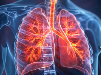 Respiratory Failure, Acute Respiratory Failure, Hypnosis in Medicine, Non-Invasive Ventilation, Emergency Medicine Research, Respiratory Care, NIV Tolerance, Patient Comfort, Critical Care, COPD Treatment, Sedation Alternatives
