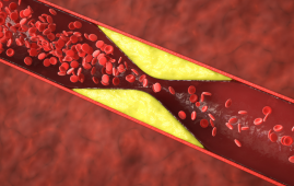 atherosclerosis, oral bacteria, viridans streptococci, coronary plaques, cardiovascular disease, bacterial biofilms, dental health and heart disease, inflammation and heart disease, TLR2 pathway, myocardial infarction risk, sudden cardiac death, oral microbes and atherosclerosis, infective endocarditis, heart disease prevention, cardiovascular microbiome