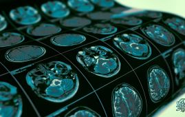 seizure prediction, epilepsy, deep learning AI, future-guided AI, EEG monitoring, personalized medicine, neurology, predictive analytics, patient safety, wearable EEG, real-time seizure forecast, clinical AI, hospital neurology, epilepsy research, AI in healthcare