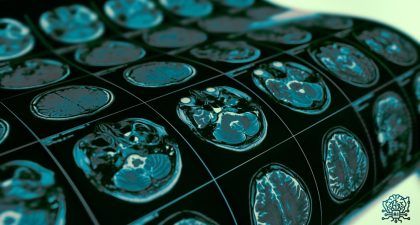 seizure prediction, epilepsy, deep learning AI, future-guided AI, EEG monitoring, personalized medicine, neurology, predictive analytics, patient safety, wearable EEG, real-time seizure forecast, clinical AI, hospital neurology, epilepsy research, AI in healthcare