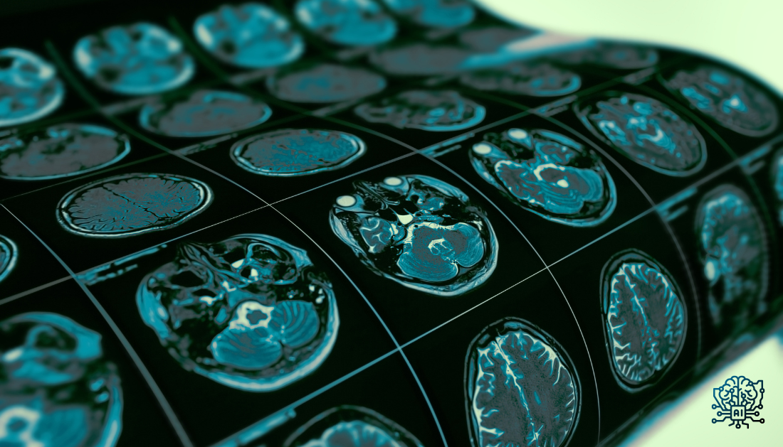 seizure prediction, epilepsy, deep learning AI, future-guided AI, EEG monitoring, personalized medicine, neurology, predictive analytics, patient safety, wearable EEG, real-time seizure forecast, clinical AI, hospital neurology, epilepsy research, AI in healthcare