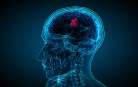 glioblastoma, focused ultrasound, brain cancer research, temozolomide, neuro-oncology, liquid biopsy, MRI-guided therapy, blood–brain barrier, clinical trials, oncology news, cancer biomarkers, UMSOM, chemotherapy delivery, HCP oncology updates, eMedEvents news