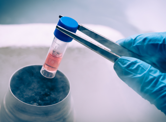 Allogeneic Stem Cell Transplants