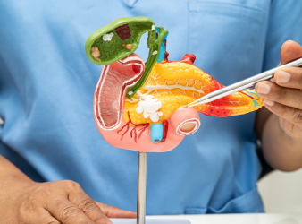 Pancreatic Cancer, Pancreatic Cancer Research, Oncology News, Cancer Therapy, KRAS Mutation, Preclinical Cancer Studies, Oncology Research, Cancer Treatment Advances, CNIO, PNAS Study