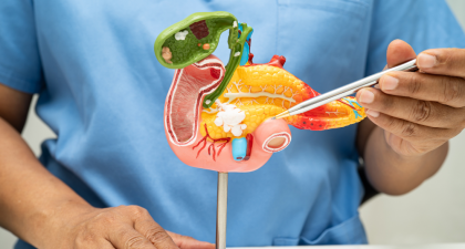 Pancreatic Cancer, Pancreatic Cancer Research, Oncology News, Cancer Therapy, KRAS Mutation, Preclinical Cancer Studies, Oncology Research, Cancer Treatment Advances, CNIO, PNAS Study