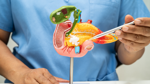 Pancreatic Cancer, Pancreatic Cancer Research, Oncology News, Cancer Therapy, KRAS Mutation, Preclinical Cancer Studies, Oncology Research, Cancer Treatment Advances, CNIO, PNAS Study