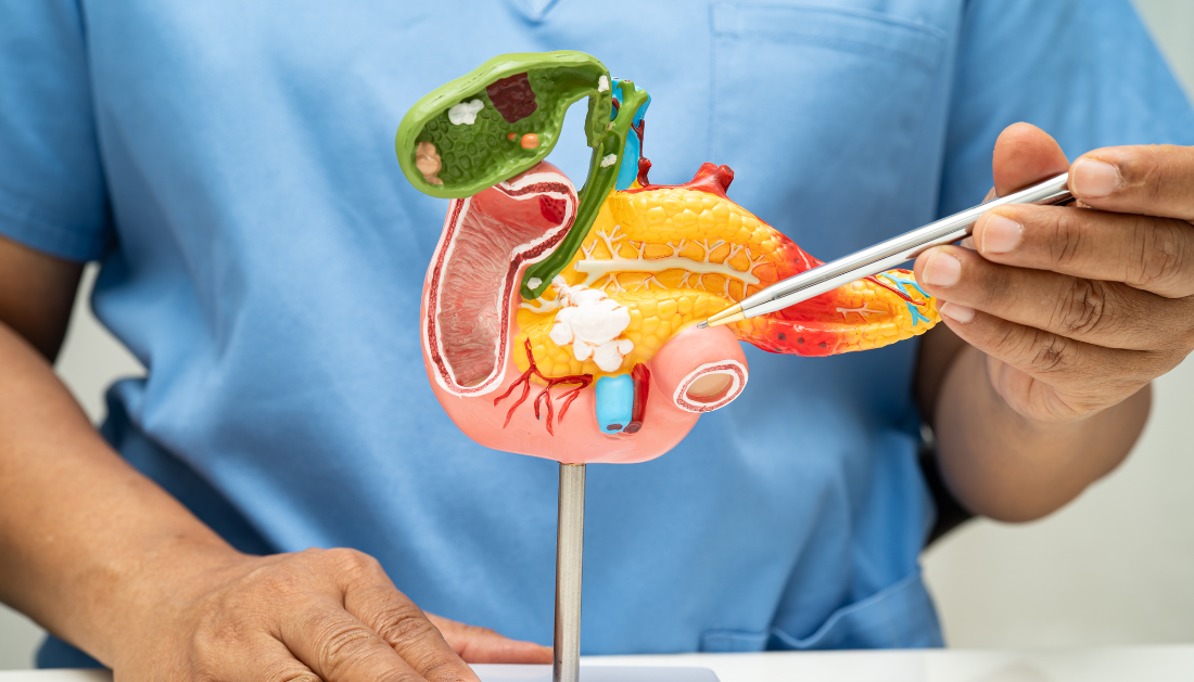 Pancreatic Cancer, Pancreatic Cancer Research, Oncology News, Cancer Therapy, KRAS Mutation, Preclinical Cancer Studies, Oncology Research, Cancer Treatment Advances, CNIO, PNAS Study