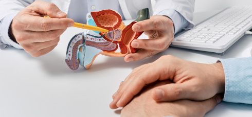 Advanced Prostate Cancer, Liquid biopsy, ctDNA testing, mCRPC, Androgen receptor alterations, Precision oncology, PARP inhibitors, AR pathway inhibitors, Treatment resistance, Genomic profiling, metastatic castration-resistant prostate cancer, ctDNA testing, androgen receptor alterations, AR amplification, treatment resistance, precision oncology, PARP inhibitors, ARPIs, taxane chemotherapy, real-time molecular testing, genomic instability, BRCA reversion mutations, personalized cancer care