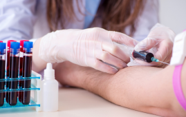 Liquid Biopsy, Epigenetic Instability, DNA methylation, Early cancer detection, Oncology diagnostics, Cell-free DNA, Cancer screening, Precision oncology, Molecular diagnostics, early cancer detection, DNA methylation variability, cell-free DNA testing, oncology diagnostics, Epigenetic Instability Index, cancer screening biomarkers, blood-based cancer test, precision oncology, lung cancer detection, breast cancer screening, machine learning in oncology, cancer epigenomics, molecular cancer diagnostics