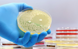 Tuberculosis research, Experimental antibiotics, Drug-resistant TB, Mycobacterium tuberculosis, ClpC1 ClpP1P2, Antibiotic resistance, Infectious disease research, TB drug development, Proteomics, Antimicrobial therapy, experimental antibiotics for tuberculosis, drug-resistant TB, Mycobacterium tuberculosis, ClpC1 ClpP1P2 complex, tuberculosis treatment research, new TB drugs, antibiotic resistance, TB protein degradation, ecumicin ilamycin cyclomarin, infectious disease research, TB drug targets, antimicrobial research, tuberculosis bacteria, TB clinical research, global TB burden