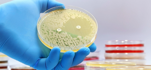 Tuberculosis research, Experimental antibiotics, Drug-resistant TB, Mycobacterium tuberculosis, ClpC1 ClpP1P2, Antibiotic resistance, Infectious disease research, TB drug development, Proteomics, Antimicrobial therapy, experimental antibiotics for tuberculosis, drug-resistant TB, Mycobacterium tuberculosis, ClpC1 ClpP1P2 complex, tuberculosis treatment research, new TB drugs, antibiotic resistance, TB protein degradation, ecumicin ilamycin cyclomarin, infectious disease research, TB drug targets, antimicrobial research, tuberculosis bacteria, TB clinical research, global TB burden