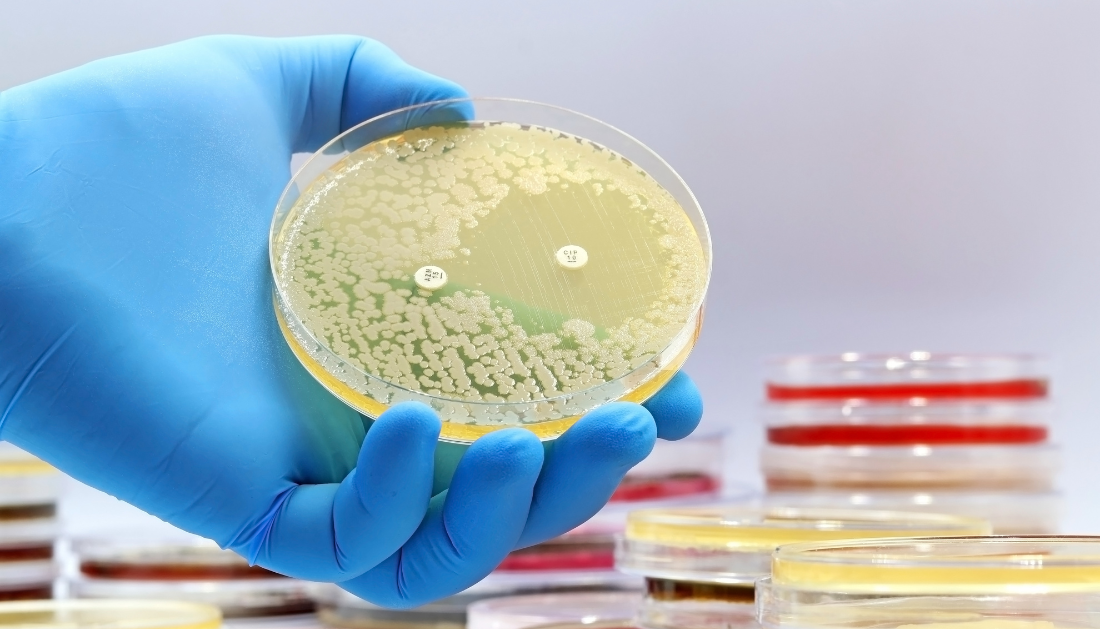 Tuberculosis research, Experimental antibiotics, Drug-resistant TB, Mycobacterium tuberculosis, ClpC1 ClpP1P2, Antibiotic resistance, Infectious disease research, TB drug development, Proteomics, Antimicrobial therapy, experimental antibiotics for tuberculosis, drug-resistant TB, Mycobacterium tuberculosis, ClpC1 ClpP1P2 complex, tuberculosis treatment research, new TB drugs, antibiotic resistance, TB protein degradation, ecumicin ilamycin cyclomarin, infectious disease research, TB drug targets, antimicrobial research, tuberculosis bacteria, TB clinical research, global TB burden