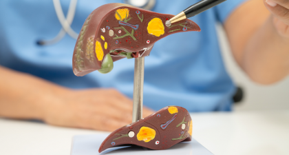 Fragmentome Technology, Liver Fibrosis Detection, Cirrhosis Screening, AI Liquid Biopsy, Cell-Free DNA, cfDNA Fragmentation, Genome-Wide Sequencing, Chronic Liver Disease, Hepatology Research, Cancer Prevention, Machine Learning in Medicine, Comorbidity Index, Precision Medicine, Translational Medicine, Early Disease Detection, liver disease biomarkers, liver fibrosis blood test, machine learning in hepatology, noninvasive liver disease diagnosis, comorbidity index prediction, cirrhosis risk assessment, precision medicine liver disease, translational medicine research