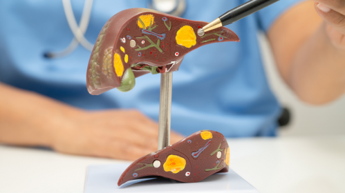 Fragmentome Technology, Liver Fibrosis Detection, Cirrhosis Screening, AI Liquid Biopsy, Cell-Free DNA, cfDNA Fragmentation, Genome-Wide Sequencing, Chronic Liver Disease, Hepatology Research, Cancer Prevention, Machine Learning in Medicine, Comorbidity Index, Precision Medicine, Translational Medicine, Early Disease Detection, liver disease biomarkers, liver fibrosis blood test, machine learning in hepatology, noninvasive liver disease diagnosis, comorbidity index prediction, cirrhosis risk assessment, precision medicine liver disease, translational medicine research