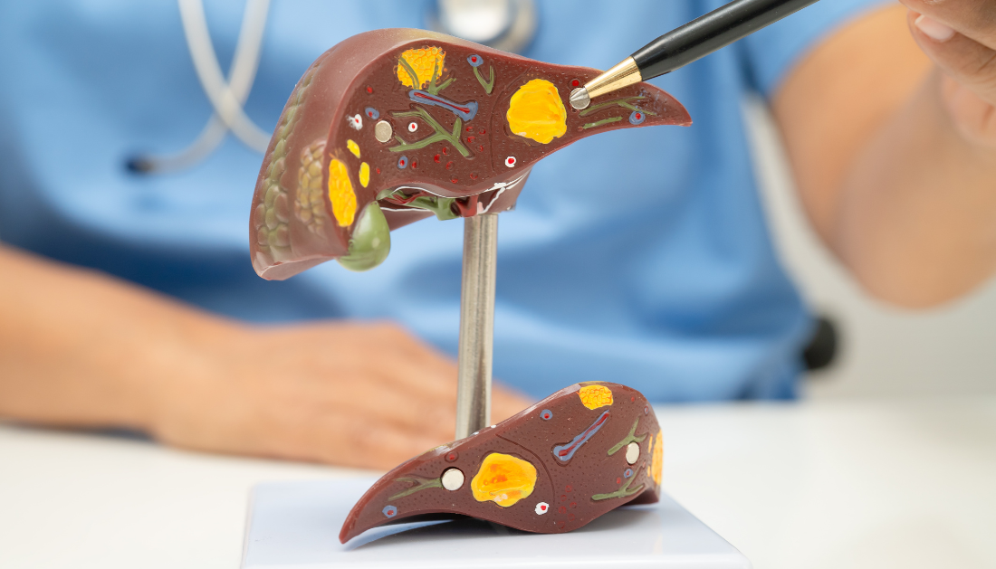 Fragmentome Technology, Liver Fibrosis Detection, Cirrhosis Screening, AI Liquid Biopsy, Cell-Free DNA, cfDNA Fragmentation, Genome-Wide Sequencing, Chronic Liver Disease, Hepatology Research, Cancer Prevention, Machine Learning in Medicine, Comorbidity Index, Precision Medicine, Translational Medicine, Early Disease Detection, liver disease biomarkers, liver fibrosis blood test, machine learning in hepatology, noninvasive liver disease diagnosis, comorbidity index prediction, cirrhosis risk assessment, precision medicine liver disease, translational medicine research