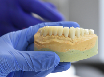 Snus, Gum Recession, Oral Health, Periodontal Disease, Tooth Decay, Nicotine Pouches, White Snus, Dental Research, Public Health Dentistry, Tobacco Effects, Pregnancy Risks, Oral Mucosa, Preventive Dentistry, Smokeless Tobacco, Dental Caries, periodontal health snus, dental caries research, oral mucosal changes, pregnancy nicotine risk, public health dentistry, tobacco oral effects, gum inflammation snus, dental research studies