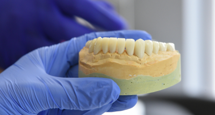 Snus, Gum Recession, Oral Health, Periodontal Disease, Tooth Decay, Nicotine Pouches, White Snus, Dental Research, Public Health Dentistry, Tobacco Effects, Pregnancy Risks, Oral Mucosa, Preventive Dentistry, Smokeless Tobacco, Dental Caries, periodontal health snus, dental caries research, oral mucosal changes, pregnancy nicotine risk, public health dentistry, tobacco oral effects, gum inflammation snus, dental research studies