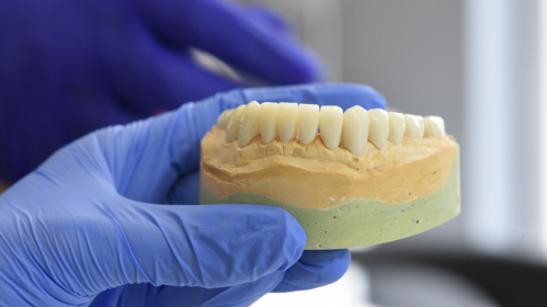 Snus, Gum Recession, Oral Health, Periodontal Disease, Tooth Decay, Nicotine Pouches, White Snus, Dental Research, Public Health Dentistry, Tobacco Effects, Pregnancy Risks, Oral Mucosa, Preventive Dentistry, Smokeless Tobacco, Dental Caries, periodontal health snus, dental caries research, oral mucosal changes, pregnancy nicotine risk, public health dentistry, tobacco oral effects, gum inflammation snus, dental research studies