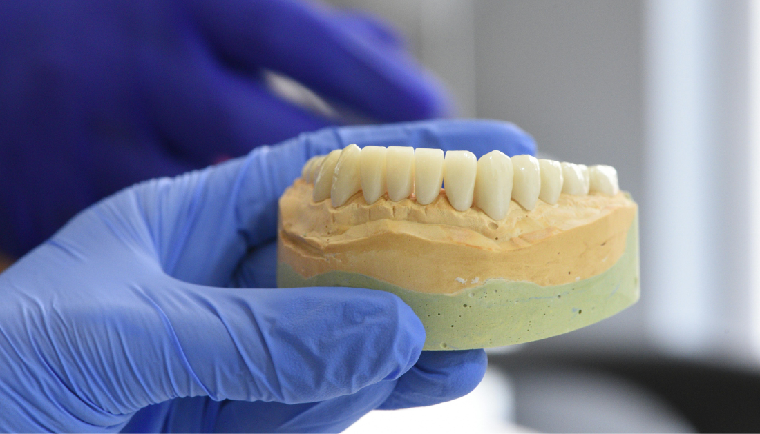 Snus, Gum Recession, Oral Health, Periodontal Disease, Tooth Decay, Nicotine Pouches, White Snus, Dental Research, Public Health Dentistry, Tobacco Effects, Pregnancy Risks, Oral Mucosa, Preventive Dentistry, Smokeless Tobacco, Dental Caries, periodontal health snus, dental caries research, oral mucosal changes, pregnancy nicotine risk, public health dentistry, tobacco oral effects, gum inflammation snus, dental research studies