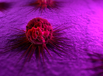 nivolumab, oral dysplasia, precancerous oral lesions, immunotherapy, checkpoint inhibitors, PD-1 inhibitor, oral cancer prevention, intralesional therapy, AACR 2026, head and neck oncology, cancer immunology, clinical trials oncology, MD Anderson research, minimally invasive oncology, tumor microenvironment, MD Anderson study, tumor immune response, CD8 T cell activation, non surgical cancer treatment, early cancer intervention, oncology clinical trial results