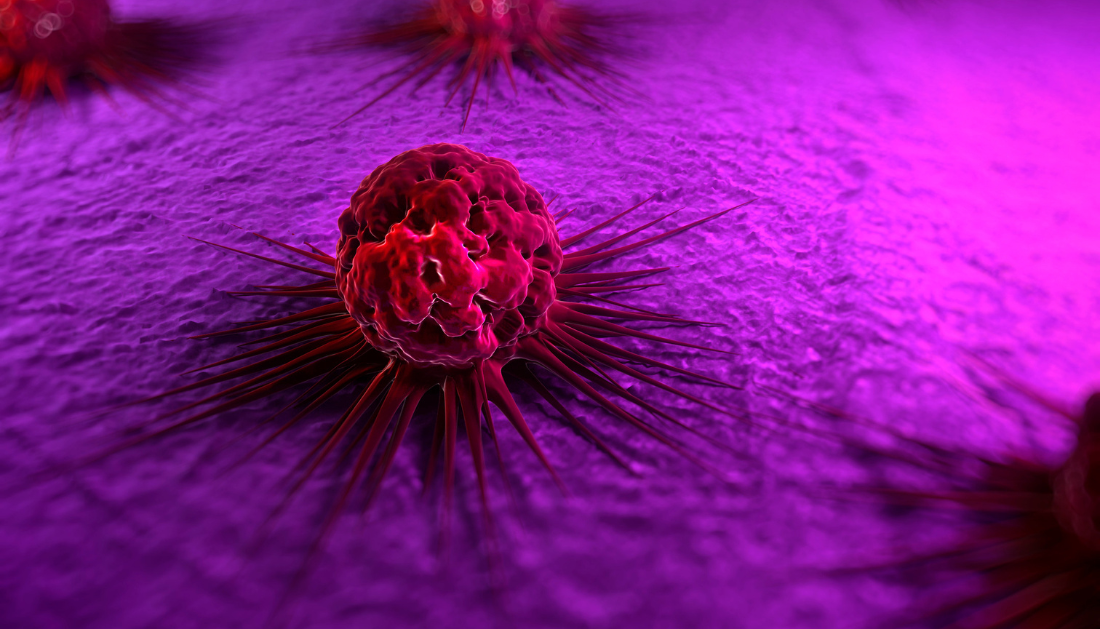 nivolumab, oral dysplasia, precancerous oral lesions, immunotherapy, checkpoint inhibitors, PD-1 inhibitor, oral cancer prevention, intralesional therapy, AACR 2026, head and neck oncology, cancer immunology, clinical trials oncology, MD Anderson research, minimally invasive oncology, tumor microenvironment, MD Anderson study, tumor immune response, CD8 T cell activation, non surgical cancer treatment, early cancer intervention, oncology clinical trial results