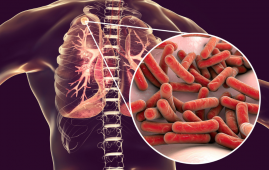 TB vaccines, tuberculosis prevention, VPM1002, Immuvac, extrapulmonary TB, pulmonary TB, latent TB infection, BCG vaccine, TB clinical trial, infectious diseases, global health, vaccine safety, pediatric TB, TB research India, immunization strategies, TB protection, pulmonary tuberculosis, latent TB infection, BCG vaccine limitations, TB prevention strategies, infectious disease research, pediatric TB protection, vaccine safety TB, TB clinical trial India, global TB burden, TB immunization