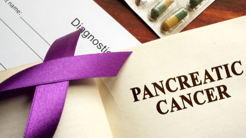 Pancreatic Cancer, Oncology Research, Cancer Treatment, Tumour Microenvironment, Immune Evasion, Combination Therapy, Precision Oncology, Biomarker Trials, Translational Oncology, Cancer Biology, Gastrointestinal Oncology, Cancer Research, Microbiome Research, Clinical Oncology, Oncology Nursing, pancreatic cancer progression, cancer hallmarks framework, oncology research updates, precision oncology, gastrointestinal oncology, microbiome and cancer, pancreatic cancer survival