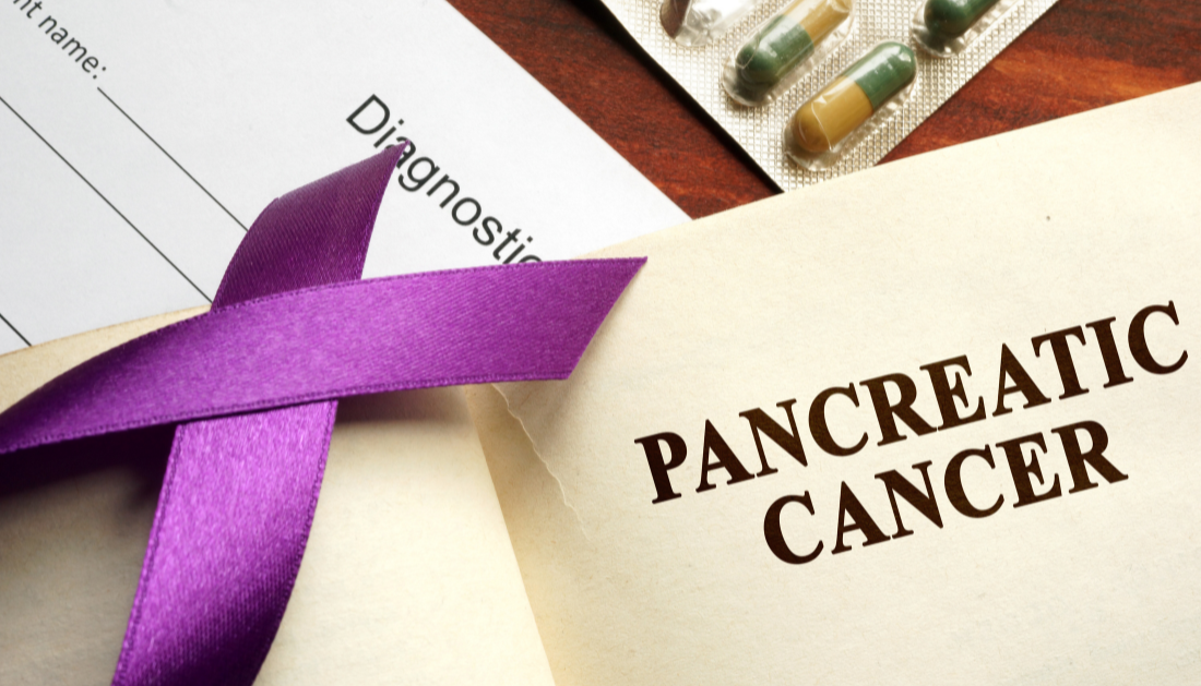 Pancreatic Cancer, Oncology Research, Cancer Treatment, Tumour Microenvironment, Immune Evasion, Combination Therapy, Precision Oncology, Biomarker Trials, Translational Oncology, Cancer Biology, Gastrointestinal Oncology, Cancer Research, Microbiome Research, Clinical Oncology, Oncology Nursing, pancreatic cancer progression, cancer hallmarks framework, oncology research updates, precision oncology, gastrointestinal oncology, microbiome and cancer, pancreatic cancer survival