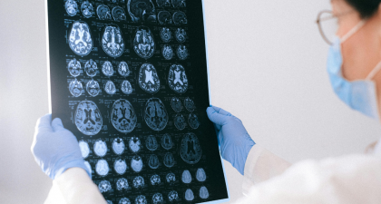 Alzheimer’s Disease, Glucosamine, Dementia, Cognitive Decline, Neurodegenerative Disease, Hyperglycosylation, Brain Health, Neurology Research, Mild Cognitive Impairment, ADRD, Glycan Metabolism, Neuroinflammation, Memory Loss, Nature Metabolism, Alzheimer’s Research, Brain Glycosylation, Neuroinflammation, Memory Deficits, Neurology Research, Alzheimer’s Disease Progression